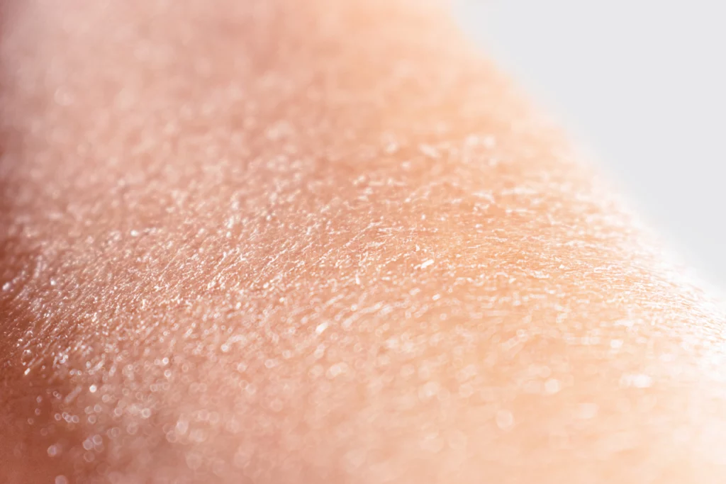 Gros plan sur une peau sèche avec texture visible